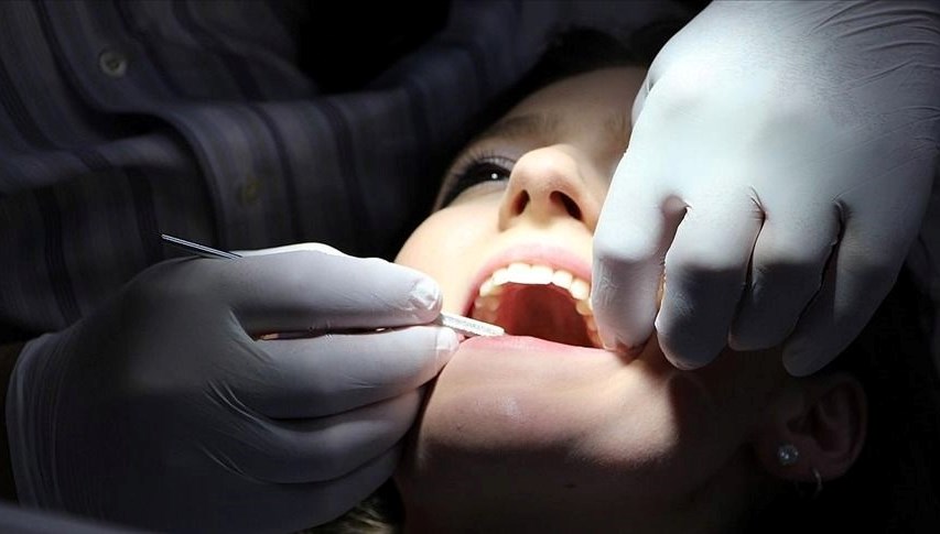 Endodonti nedir, nasıl yapılır? Endodonti hakkında bilgiler