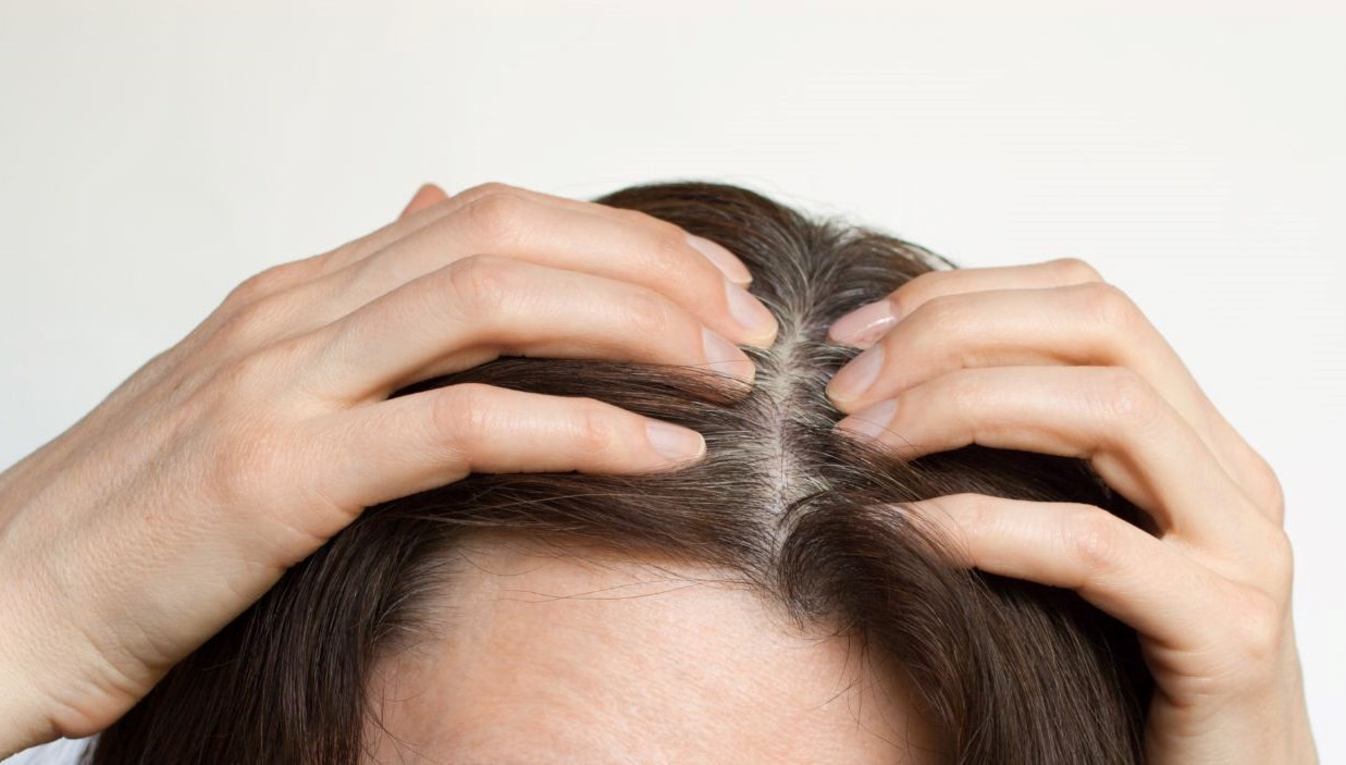Saçlardaki beyazlaşmayı bilakis çevirmek yahut önlemek mümkün mü? Umut veren araştırma