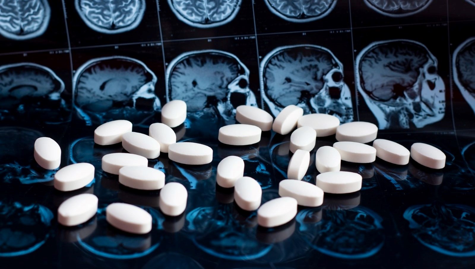 Alzheimer’a karşı yeni ilaç: Tedavide dönüm noktası olabilir