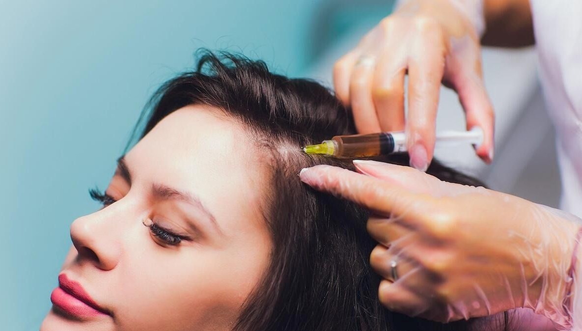 Saç dökülmesine karşı yeni tedbir: PRP nedir, nasıl uygulanır? PRP ne işe fayda?